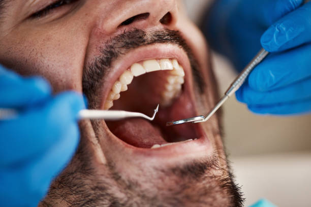 Best Chipped Tooth Repair Near Me  in Farngton, MI