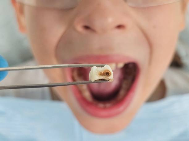 Best Cracked Tooth Emergency Dentist  in Farngton, MI